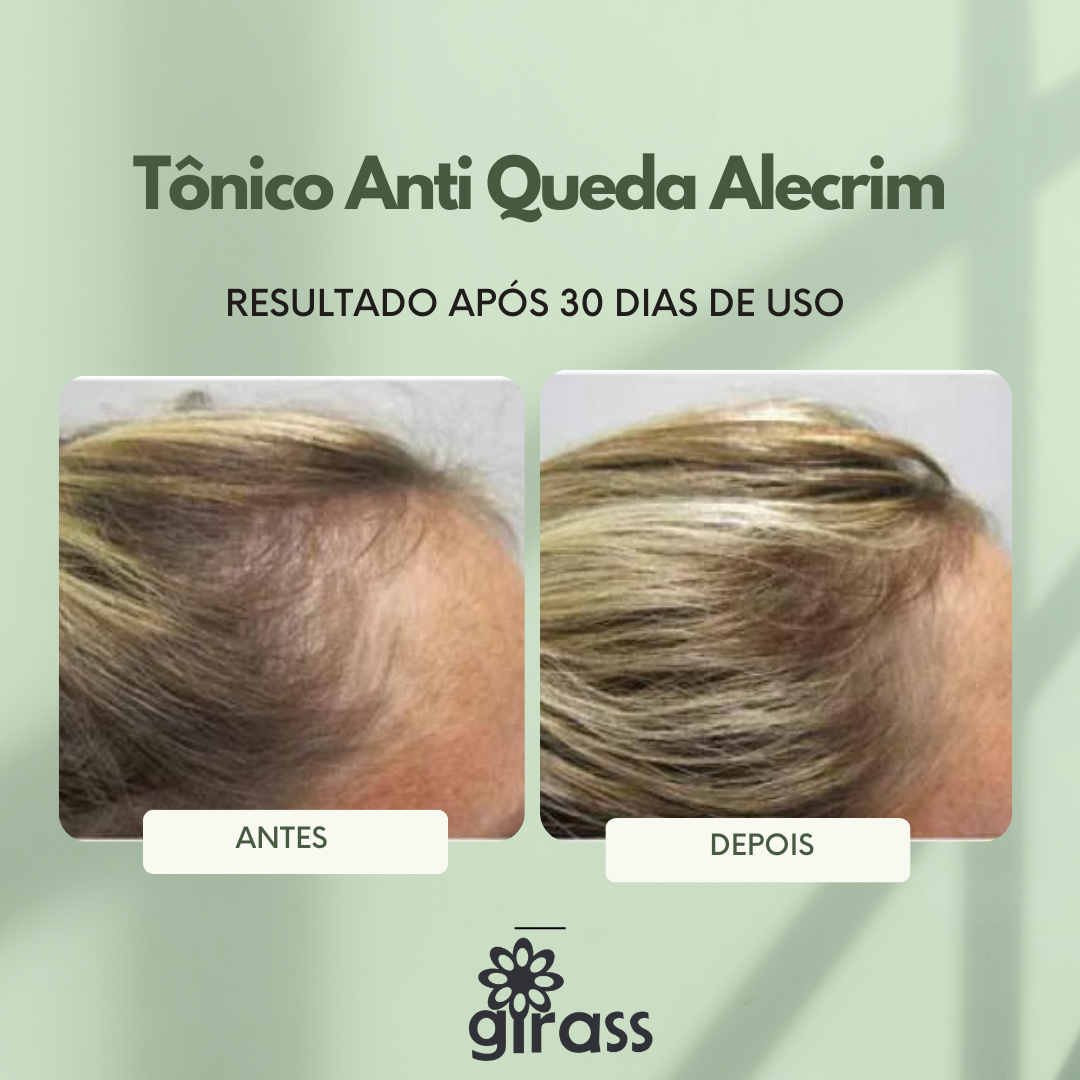 tonico antiQueda alecrim