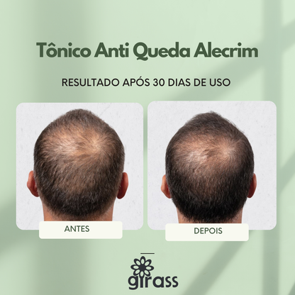 tonico antiQueda alecrim